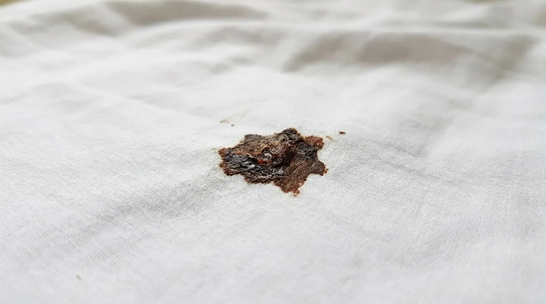 Dried blood spot on white fabric